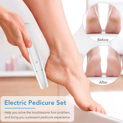 🔥 BUY 3 GET 1 FREE! ⚡ Electric Feet Callus Remover – 50K+ Sold! Gentle Exfoliation & Smooth Skin in Minutes ❤️👣📦