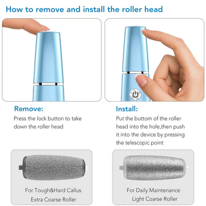 🔥 BUY 3 GET 1 FREE! ⚡ Electric Feet Callus Remover – 50K+ Sold! Gentle Exfoliation & Smooth Skin in Minutes ❤️👣📦