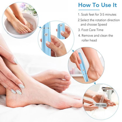 🔥 BUY 3 GET 1 FREE! ⚡ Electric Feet Callus Remover – 50K+ Sold! Gentle Exfoliation & Smooth Skin in Minutes ❤️👣📦