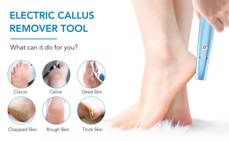🔥 BUY 3 GET 1 FREE! ⚡ Electric Feet Callus Remover – 50K+ Sold! Gentle Exfoliation & Smooth Skin in Minutes ❤️👣📦
