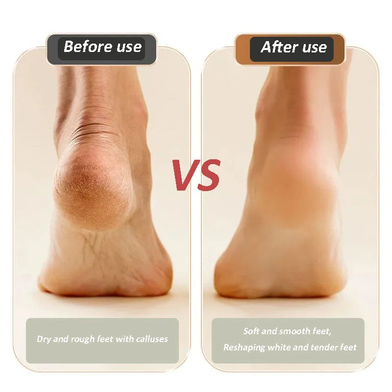 🔥 Last Chance! Up to 49% Off! 🔥USB Rechargeable Foot Repair and Grinding Device