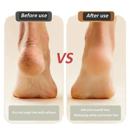 🔥 Last Chance! Up to 49% Off! 🔥USB Rechargeable Foot Repair and Grinding Device