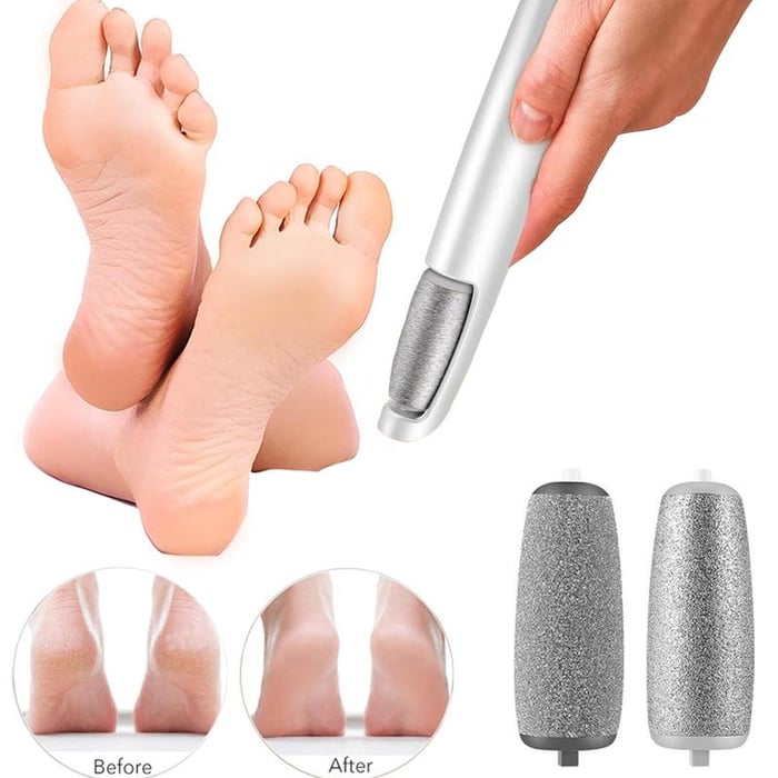🔥 BUY 3 GET 1 FREE! ⚡ Electric Feet Callus Remover – 50K+ Sold! Gentle Exfoliation & Smooth Skin in Minutes ❤️👣📦
