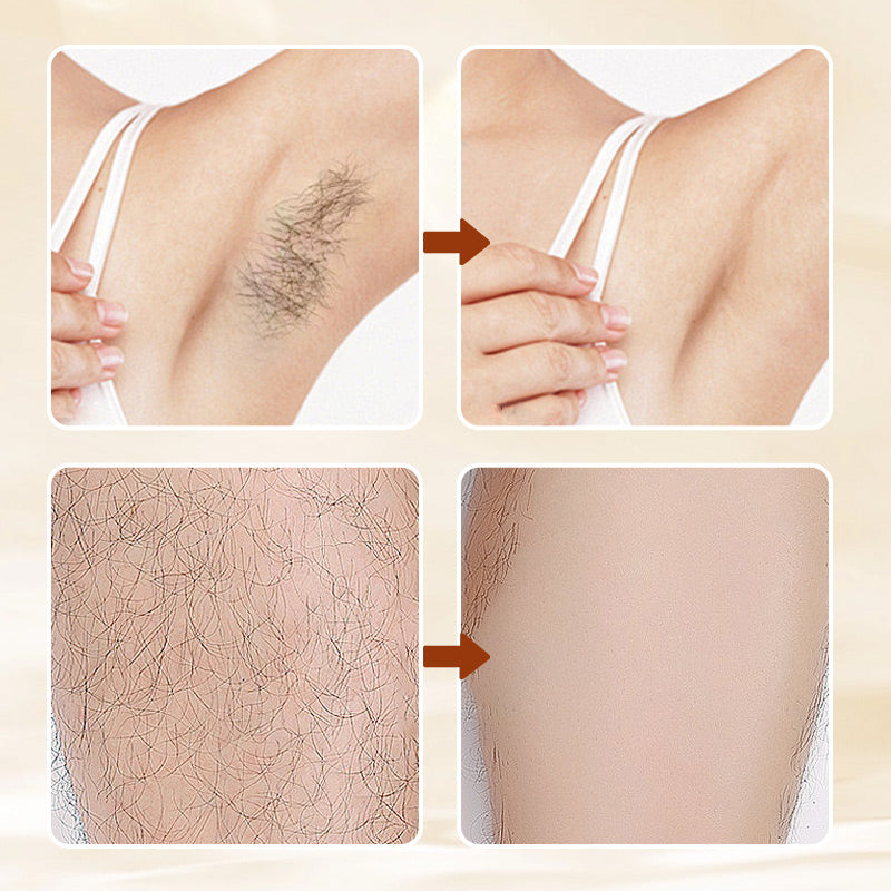 🧴50% OFF!🥰Versatile Aromatic Hair Removal Cream – Fast, Gentle & Fragrance-Infused for Silky Smooth Skin ✨