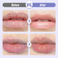 ✨ Buy 1 Get 1 Free✨ Plumping & Anti-Wrinkle Hydrating Lip Serum