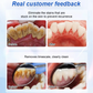 🦷 Brighten & Protect Your Smile Today! 🦷Whitening Tooth Care Restorative Toothpaste