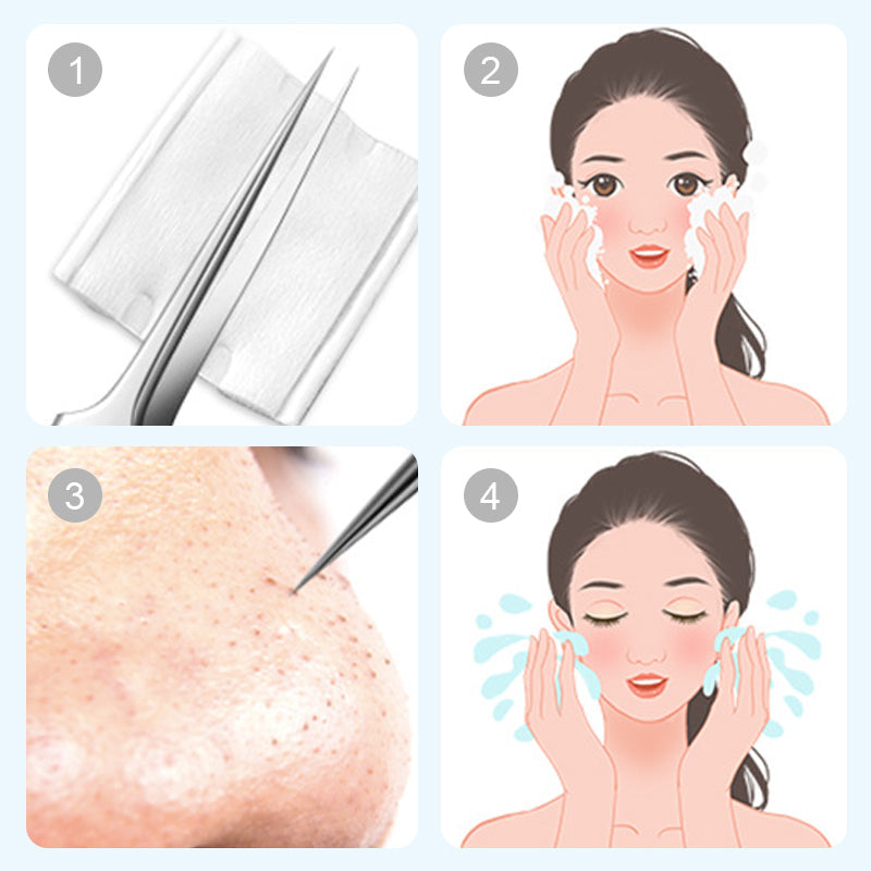 💓HOT SALE 57% OFF💥Stainless Steel Blackhead Removal Kit (with free alcohol pads)
