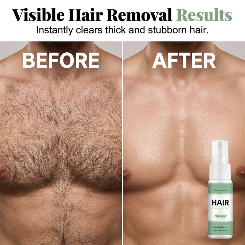 💚 LIMITED-TIME 50% OFF! Gentle Fast Acting Hair Removal Spray, Painless Body Depilatory Spray for Men & Women